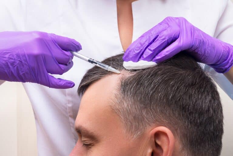 PRP treatment for hair